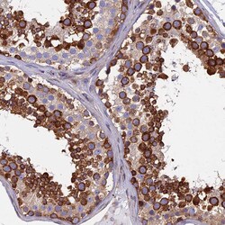 Invitrogen YBX1 Polyclonal Antibody 100 &mu;L; Unconjugated:Antibodies,