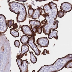 Invitrogen ST3GAL5 Polyclonal Antibody 100 &mu;L; Unconjugated:Antibodies,
