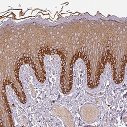 Invitrogen DAPK1 Polyclonal Antibody 100 &mu;L; Unconjugated:Antibodies,