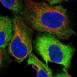 Invitrogen EEF2 Polyclonal Antibody 100 &mu;L; Unconjugated:Antibodies,