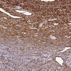 Invitrogen EEF2 Polyclonal Antibody 100 &mu;L; Unconjugated:Antibodies,