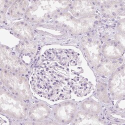 Invitrogen MUC5AC Polyclonal Antibody 100 &mu;L | Buy Online | Invitrogen&trade; | Fisher Scientific