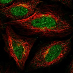 Invitrogen ADAT1 Polyclonal Antibody 100 &mu;L; Unconjugated:Antibodies,