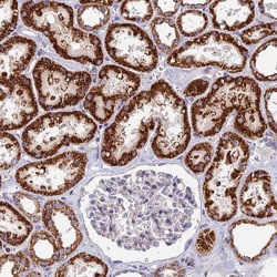Invitrogen ADAT1 Polyclonal Antibody 100 &mu;L; Unconjugated:Antibodies,