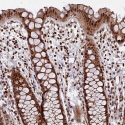 Invitrogen LEO1 Polyclonal Antibody 100 &mu;L; Unconjugated:Antibodies,