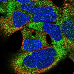 Invitrogen TSR3 Polyclonal Antibody 100 &mu;L; Unconjugated:Antibodies,