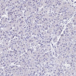 Invitrogen GP340 Polyclonal Antibody 100 &mu;L | Buy Online | Invitrogen&trade; | Fisher Scientific