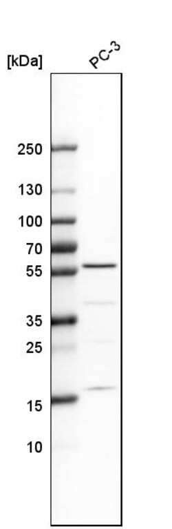Invitrogen IP6K1 Polyclonal Antibody 100 &mu;L; Unconjugated:Antikroppar