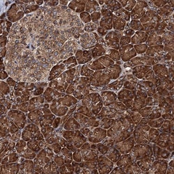 Invitrogen Bora Polyclonal Antibody 100 &mu;L; Unconjugated:Antibodies,
