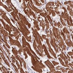 Invitrogen TID1 Polyclonal Antibody 100 &mu;L; Unconjugated:Antibodies,