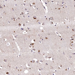 Invitrogen LSM4 Polyclonal Antibody 100 &mu;L; Unconjugated:Antibodies,