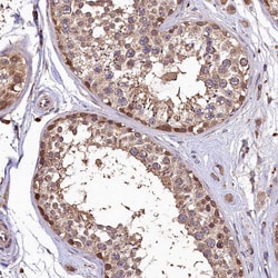 Invitrogen LSM4 Polyclonal Antibody 100 &mu;L; Unconjugated:Antibodies,