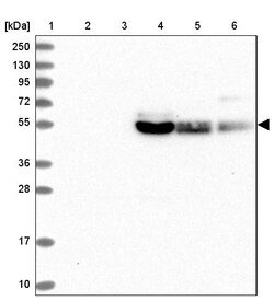 Invitrogen GLUT10 Polyclonal Antibody 100 &mu;L; Unconjugated:Antibodies,