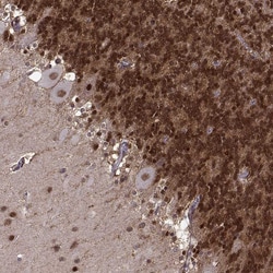Invitrogen FTO Polyclonal Antibody 100 &mu;L; Unconjugated:Antibodies,