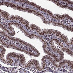 Invitrogen FTO Polyclonal Antibody 100 &mu;L; Unconjugated:Antibodies,