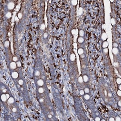 Invitrogen ORP2 Polyclonal Antibody 100 &mu;L; Unconjugated:Antibodies,