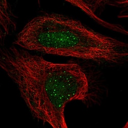Invitrogen CENPT Polyclonal Antibody 100 &mu;L; Unconjugated:Antibodies,