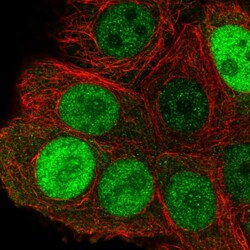 Invitrogen KPNA2 Polyclonal Antibody 100 &mu;L; Unconjugated:Antibodies,