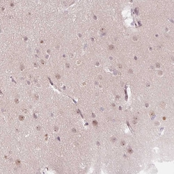 Invitrogen KPNA2 Polyclonal Antibody 100 &mu;L; Unconjugated:Antibodies,