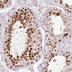 Invitrogen KPNA2 Polyclonal Antibody 100 &mu;L; Unconjugated:Antibodies,