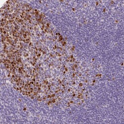 Invitrogen KPNA2 Polyclonal Antibody 100 &mu;L; Unconjugated:Antibodies,