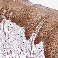 Invitrogen eIF2 beta Polyclonal Antibody 100 &mu;L; Unconjugated:Antibodies,