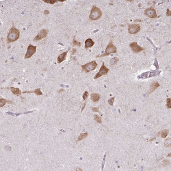 Invitrogen LRRC9 Polyclonal Antibody 100 &mu;L; Unconjugated:Antibodies,