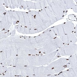 Invitrogen UBA2 Polyclonal Antibody 100 &mu;L | Buy Online | Invitrogen&trade; | Fisher Scientific