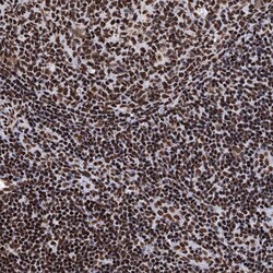 Invitrogen UBA2 Polyclonal Antibody 100 &mu;L | Buy Online | Invitrogen&trade; | Fisher Scientific