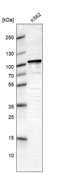 Invitrogen UBA2 Polyclonal Antibody 100 &mu;L | Buy Online | Invitrogen&trade; | Fisher Scientific