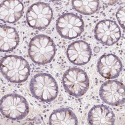 Invitrogen CD83 Polyclonal Antibody 100 &mu;L; Unconjugated:Antibodies,