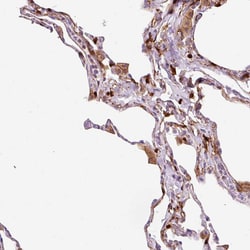 Invitrogen CD83 Polyclonal Antibody 100 &mu;L; Unconjugated:Antibodies,