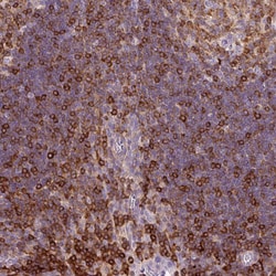 Invitrogen CD83 Polyclonal Antibody 100 &mu;L; Unconjugated:Antibodies,