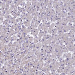Invitrogen IDH3A Polyclonal Antibody 100 &mu;L; Unconjugated:Antibodies,