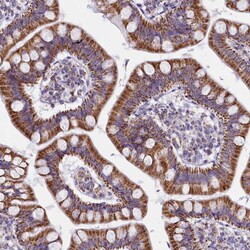 Invitrogen IDH3A Polyclonal Antibody 100 &mu;L; Unconjugated:Antibodies,