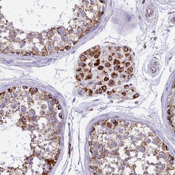 Invitrogen IDH3A Polyclonal Antibody 100 &mu;L; Unconjugated:Antibodies,
