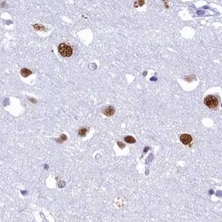 Invitrogen SUGP2 Polyclonal Antibody 100 &mu;L; Unconjugated:Antibodies,