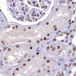 Invitrogen SUGP2 Polyclonal Antibody 100 &mu;L; Unconjugated:Antibodies,