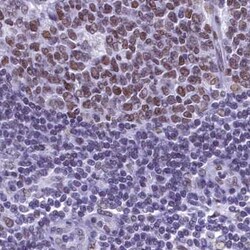 Invitrogen SUGP2 Polyclonal Antibody 100 &mu;L; Unconjugated:Antibodies,