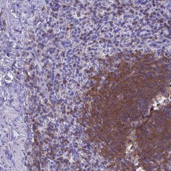 Invitrogen Septin 1 Polyclonal Antibody 100 &mu;L; Unconjugated:Antibodies,