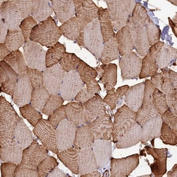 Invitrogen GYS1 Polyclonal Antibody 100 &mu;L; Unconjugated:Antibodies,