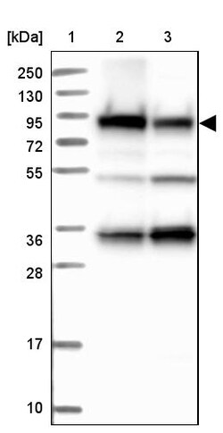 Invitrogen GYS1 Polyclonal Antibody 100 &mu;L; Unconjugated:Antibodies,