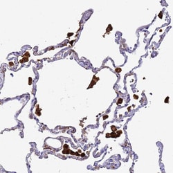 Invitrogen Ferritin Light Chain Polyclonal Antibody 100 &mu;L; Unconjugated:Antibodies,