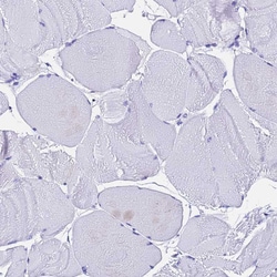 Invitrogen Ferritin Light Chain Polyclonal Antibody 100 &mu;L; Unconjugated:Antibodies,