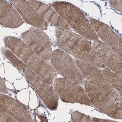 Invitrogen GLE1 Polyclonal Antibody 100 &mu;L; Unconjugated:Antibodies,