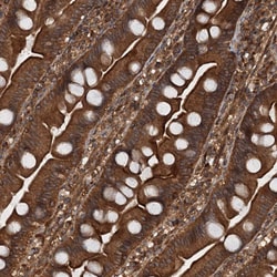 Invitrogen GLE1 Polyclonal Antibody 100 &mu;L; Unconjugated:Antibodies,