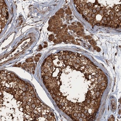 Invitrogen GLE1 Polyclonal Antibody 100 &mu;L; Unconjugated:Antibodies,