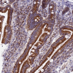Invitrogen DCI Polyclonal Antibody 100 &mu;L; Unconjugated:Antibodies,