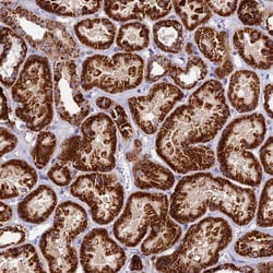 Invitrogen DCI Polyclonal Antibody 100 &mu;L; Unconjugated:Antibodies,