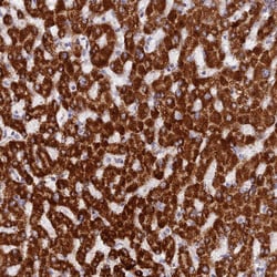 Invitrogen DCI Polyclonal Antibody 100 &mu;L; Unconjugated:Antibodies,